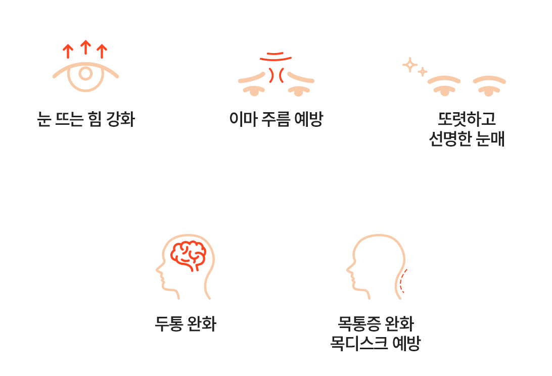 눈매교정 5가지 효과 안내