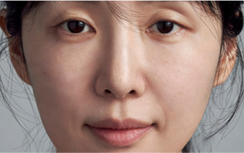 채취 및 주입