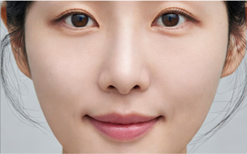 수술 후
